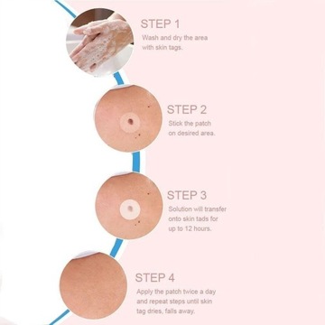 72 шт. ПАТЧИ ДЛЯ УДАЛЕНИЯ БОРОРОДОК