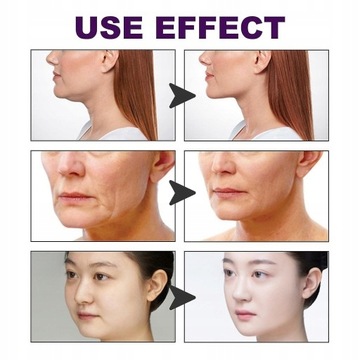 Пластырь-лифтинг для лица Face Shaping Lifting Firm