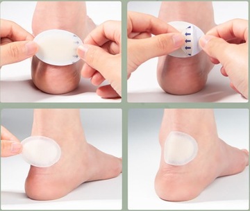 ГИДРОКОЛОЛИДНЫЕ ПЛАСТКИ ОТ МЫСЛИ, Ссадины, ОТПЕЧАТКИ