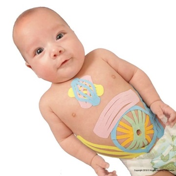 Кинезиотейпирование, подтяжка бюста лица