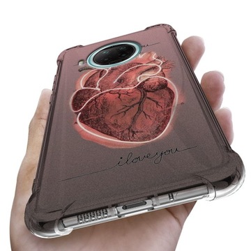 Etui Antishock do XIAOMI REDMI NOTE 9 5G Top Wzory