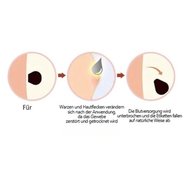 КРЕМ ЛЕНАРО С ПЧЕЛИНЫМ ЯДОМ ДЛЯ УДАЛЕНИЯ БОРОДОНОК И РОДИНОК, 30Г
