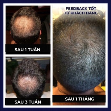 масло для роста волос питает волосяные луковицы