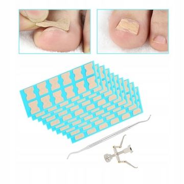 120 Х ПЛАТЧЕК ОТ ВРАСТАЮЩИХ НОГТЕЙ, РЕМЕНЬ С ПРЯЖКОЙ