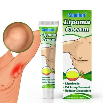 20g Lipoma Care Cream Lipoma Removal Cream