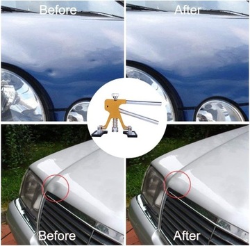 Комплект для удаления вмятин на кузове автомобиля