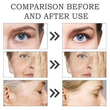 РАЗГЛАЖИВАЮЩАЯ, УВЛАЖНЯЮЩАЯ И ПИТАТЕЛЬНАЯ СЫВОРОТКА ПРОТИВ МОРЩИН - 30МЛ