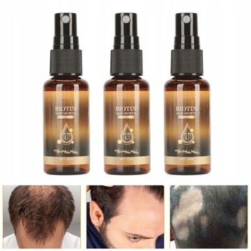 3 шт. спрей для роста волос с биотином для восстановления густых волос NI