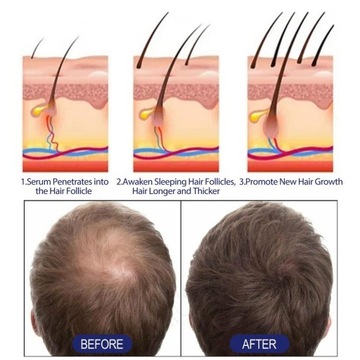 Pianka Na Porost Włosów Naturalna Przez