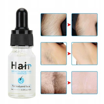 ИНГИБИТОР ПОСЛЕ ДЕПИЛЯЦИИ ЗАДЕРЖИВАЕТ РОСТ ВОЛОС 10мл