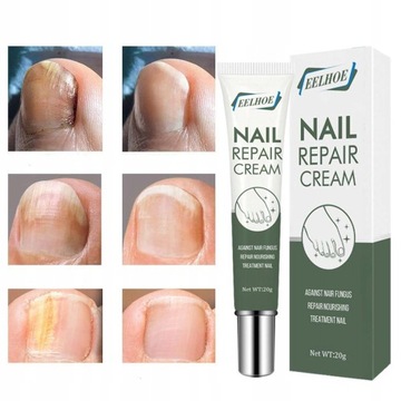 Onychomycosis Paronychia Krem Do Pielęgnacji Stóp