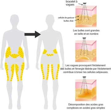 Ультразвуковой браслет Josfit, Ультразвуковой браслет, Титан Lympunclog