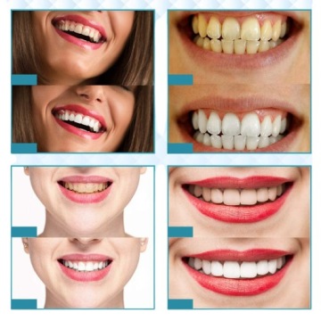 Набор для отбеливания зубов с лампой DentalForce 32LED