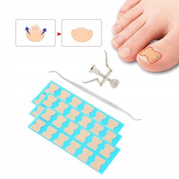 36 X PLASTRY NA WRASTAJĄCE PAZNOKCIE KLAMRA PASK