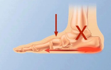 Обертывание для пяточных шпор ПЛАНТАРНЫЙ ФАСЦИИТ 2 шт.