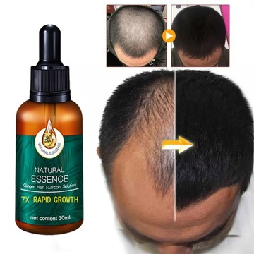 30ml Ginger Growth Liquid Anti Loss Hair Growth