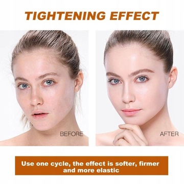 КОЛЛАГЕН-ЛИФТИНГ-БЕЛКОВЫЕ НИТИ - НАБОР