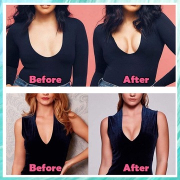 FORLADY Лента для коррекции груди