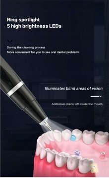 Xiaomi Ultrasonic Electric Dental Scaler Stai