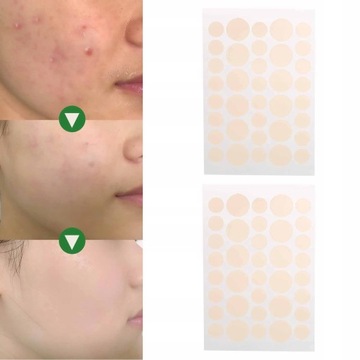 ТОЧЕЧНЫЕ ПАТЧИ ОТ Прыщей 144X