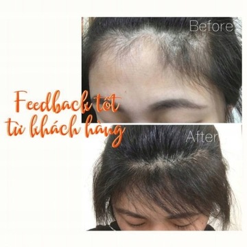 масло для роста волос питает волосяные луковицы