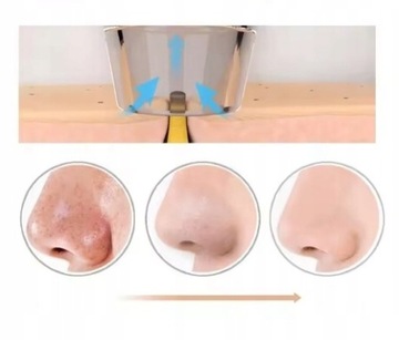 УСТРОЙСТВО ДЛЯ УДАЛЕНИЯ ЧЁРНОСТЕЙ УХОД ЗА КОЖЕЙ ЛИЦА NOS SPA