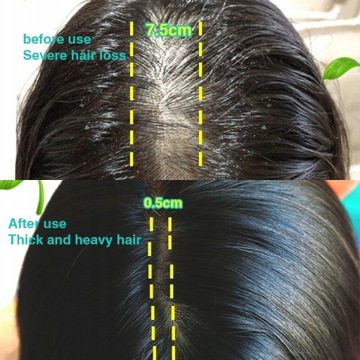 Сыворотка для волос для быстрого роста волос