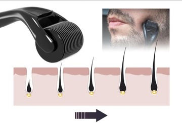 DERMA ROLLER do włosów na porost włosów zakola łysienie + OLEJEK na porost