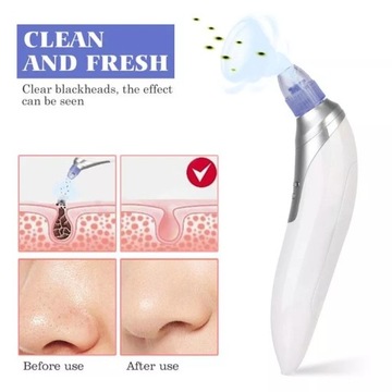 Пылесос от черных точек 5 в 1 Мощный пылесос для микродермабразии