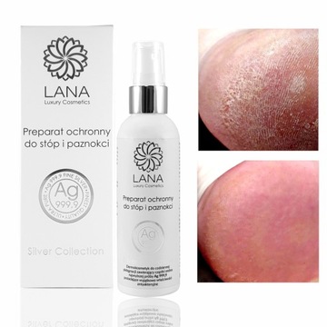 LANA jony srebra - SPRAY 100 ml ZROGOWACIAŁE PIĘTY