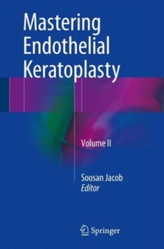 Mastering Endothelial Keratoplasty SOOSAN JACOB