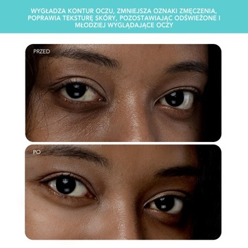 FOREO IRIS 2 Массажер для глаз, Мятный