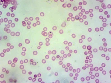 DLT-Cam Basic 2-мегапиксельная камера для микроскопа с USB 2.0