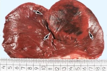 Для долгой жизни HEARTTOOL кровеносные сосуды, холестерин, высокое сердечное давление на 30 дней