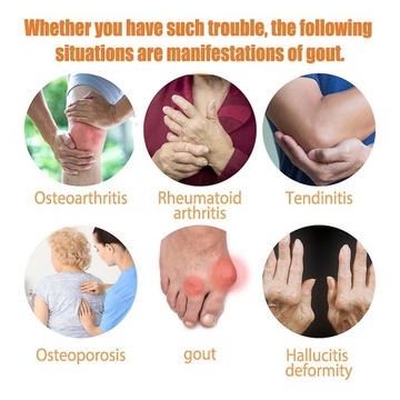 Спрей с пчелиным ядом для суставов и костей, Спрей с пчелиным ядом Тера