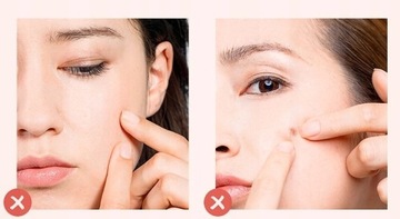 ZESTAW ŁYŻECZKI UNNY USUWANIE ZASKÓRNIKÓW WĄGRÓW