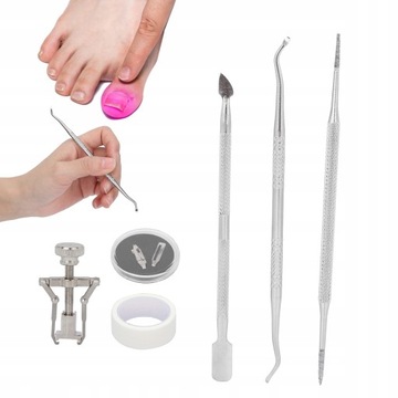 KOREKCJA WRASTAJĄCYCH PAZNOKCI ZDATNY NOSZENIA