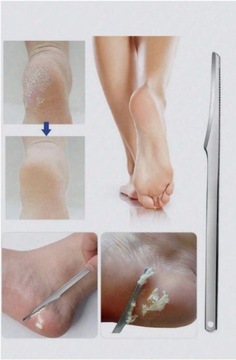 НОЖ СКРЕБОК ДЛЯ ПЯТОК ДЛЯ УДАЛЕНИЯ МОЛОДЫХ ДЛЯ МЕТАЛЛИЧЕСКОГО ПЕДИКЮРА