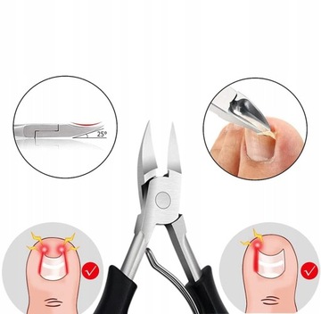 НАБОР ДЛЯ ВРАСТАНИЯ НОГТЕЙ НА ПАЛЬЦАХ ПАЛЬЦЕВ, КУСАЧКИ ДЛЯ РУКИ