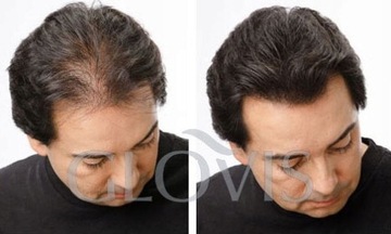 Concealer GLOVIS - Kasztanowy - Chestnut