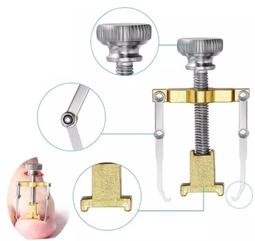 НАБОР ДЛЯ КОРРЕКЦИИ ВРАСТНЫХ НОГТЕЙ