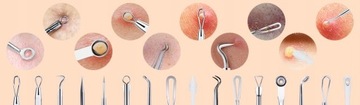 Набор для удаления черных точек, ложки UNY Pimples Wągrów, двусторонние, 8 шт.