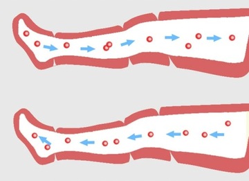 Прессотерапия, лимфодренаж, массажер для ног, массаж