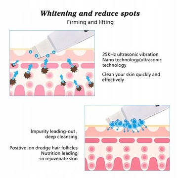 Ультразвуковой скруббер для чистки кожи лица Deep