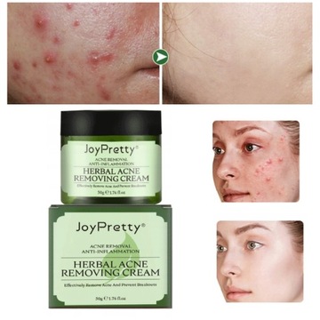 JoyPretty Крем для лица от прыщей на травах и шрамов от прыщей
