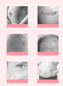 3x Derma Roller CIAŁO TWARZ OCZY TYTAN Dermaroller