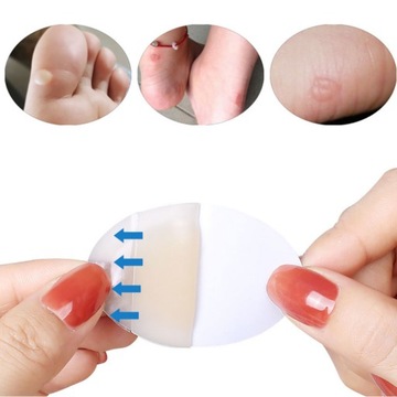 ГИДРОКОЛОЛИДНЫЕ ПЛАСТКИ ОТ МЫСЛИ, Ссадины, ОТПЕЧАТКИ