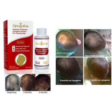 Липогаин для мужчин сыворотка, травяная смесь блокатора ДГТ