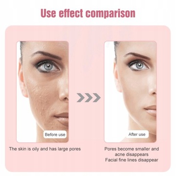 Светодиодный фотонный светотерапевтический массажер для лица BeautyAging