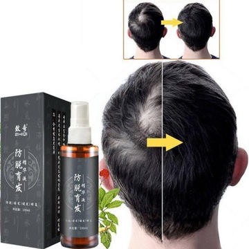 ęgnacja uroda utrata włosów dla kobiet i mnie P6p9